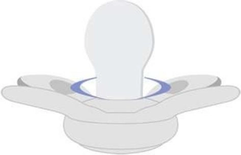 Orthodontic silicone teat