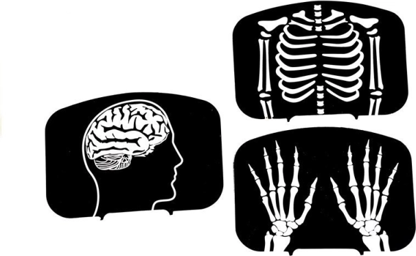 Learning through fun with X-rays